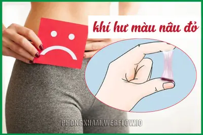 Khí hư màu nâu đỏ là bị bệnh gì có nguy hiểm không?
