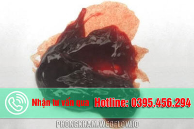 Kinh nguyệt màu đen vón cục 7 nguyên nhân và cách chữa trị