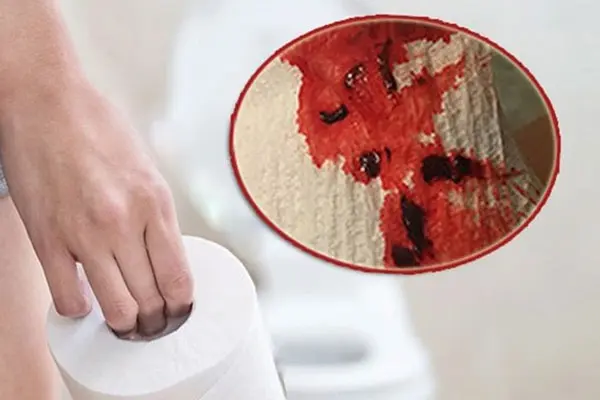 Kinh nguyệt ra nhiều cục máu đông có sao không?