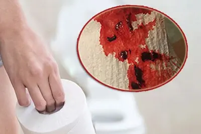 Kinh nguyệt ra nhiều cục máu đông có sao không? cách chữa