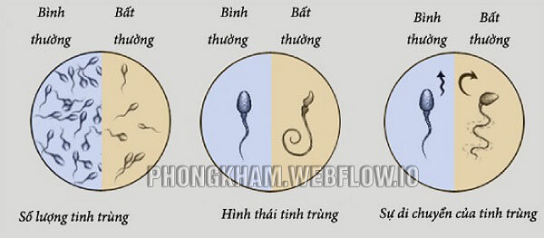 Quan sát màu sắc của tinh dịch khi xuất ra