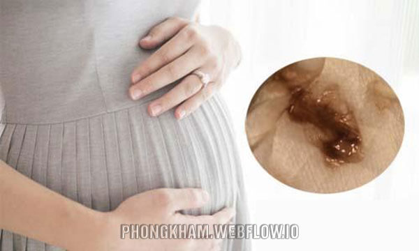 4 Nguyên nhân thường gặp gây ra khí hư khi mang thai: