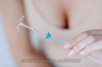 [Giải đáp] Nên đặt vòng hay uống thuốc tránh thai?