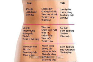 10 Nguyên nhân gây đau bụng dưới bên trái, phải chính xác nhất