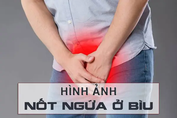 Tìm hiểu nguyên nhân nổi nốt ngứa ở bìu là gì?