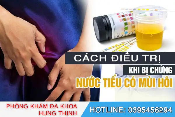Hướng dẫn cách điều trị nước tiểu có mùi hôi