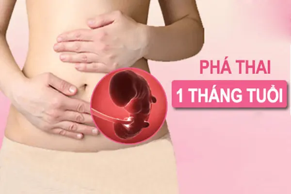 Phương pháp phá thai 1 tháng tuổi như thế nào?