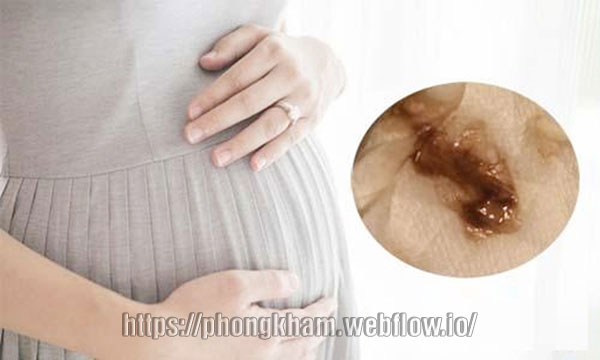 Khí hư có màu vàng khi mang thai 3 tháng đầu