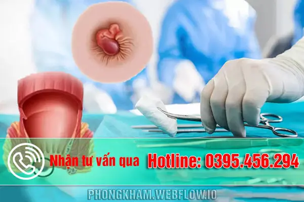 Review cắt trĩ bao lâu thì lành?