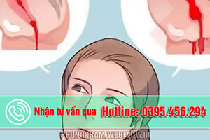Sản dịch sau sinh là gì? Sau sinh bao lâu thì hết?