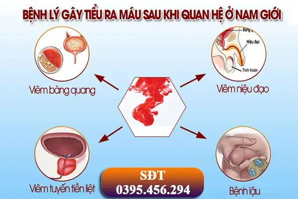 Cách khắc phục tình trạng đi tiểu ra máu sau khi quan hệ tình dục