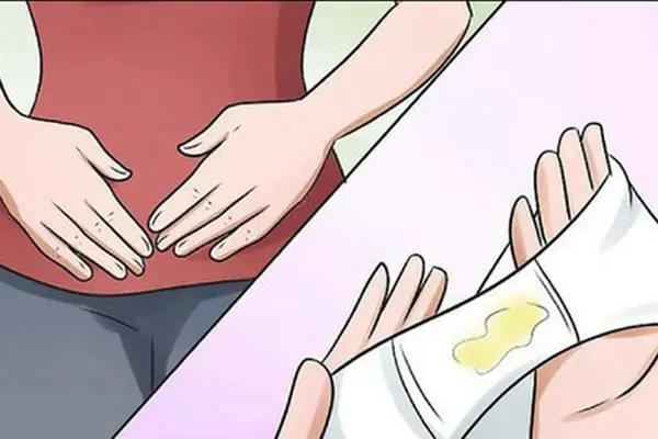 Cách xử lý khi đáy quần lót có màu vàng