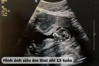 Thai 13 tuần nặng bao nhiêu BS Trần Thị Thành giải đáp