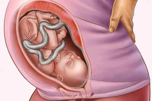 Khi thai 30 tuần thì mẹ tăng bao nhiêu cân là phù hợp?