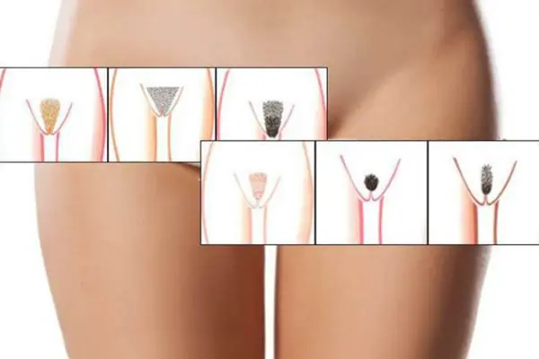 Tạo hình vùng kín nghệ thuật nắm bắt xu hướng