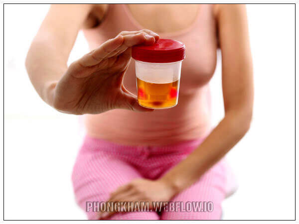 Các bệnh viêm nhiễm phụ khoa ở nữ giới gây tiểu buốt, tiểu ra máu