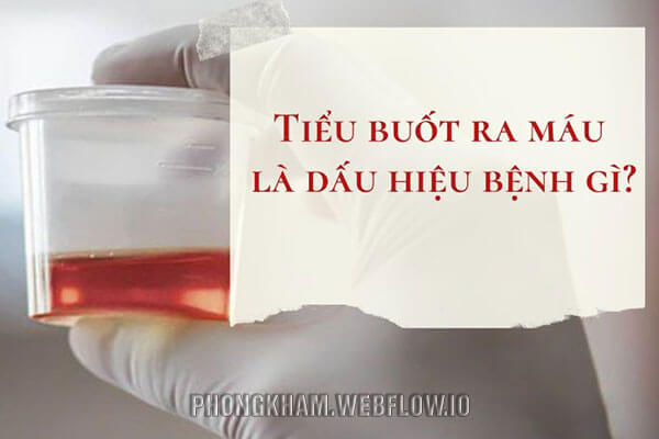 Tiểu buốt ra máu là gì có nguy hiểm không?
