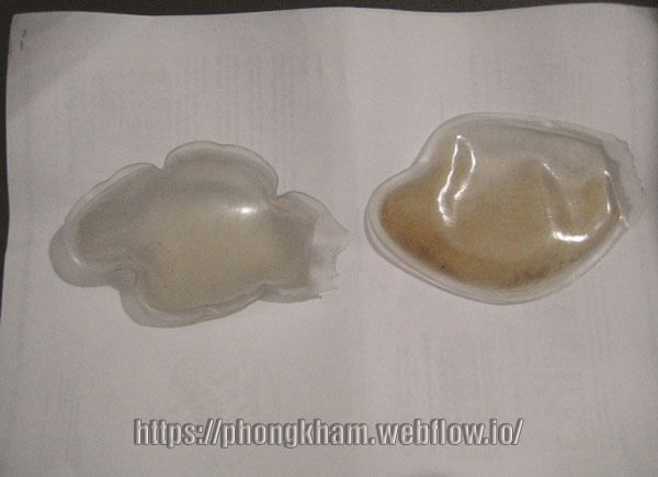 Tinh trùng có màu vàng do yếu tố sinh lý