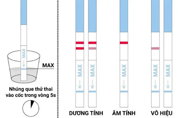 Trễ kinh 20 ngày thử que 1 vạch đậm có thai không?