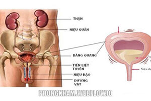 Viêm bàng quang cấp ở nam, nữ giới 7 nguyên nhân thường gặp gây bệnh