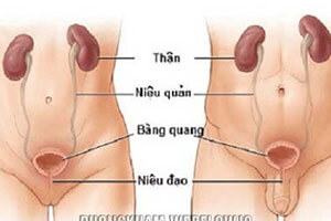 Viêm niệu đạo là gì? nguyên nhân triệu chứng cần làm gì khi bị bệnh