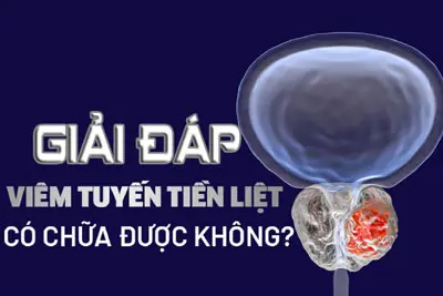 Viêm tuyến tiền liệt có chữa được không? BS Nguyễn Lương Xu tư vấn