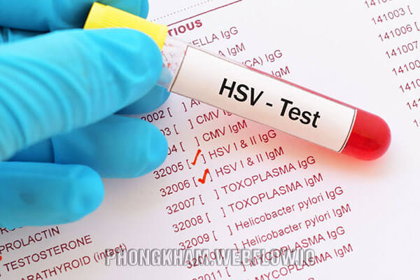 Xét nghiệm HSV ở đâu chọn Phòng khám Đa khoa Hưng Thịnh