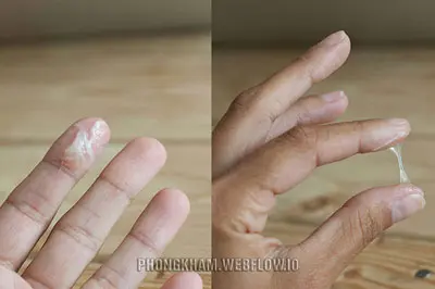 Vùng kín bị ngứa và có dịch trắng nguyên nhân cách khắc phục hiệu quả