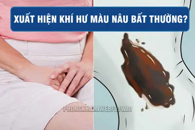 Vùng kín ra dịch màu nâu đen không mùi nguyên nhân cách xử lý