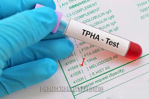 Thời điểm có kết quả xét nghiệm giang mai