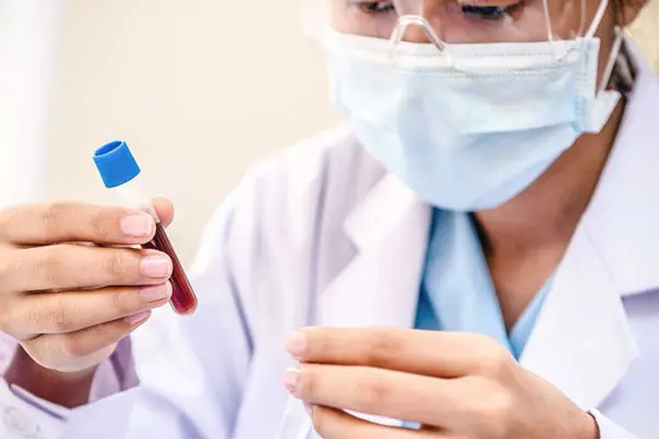 Xét nghiệm máu có phát hiện sùi mào gà không?