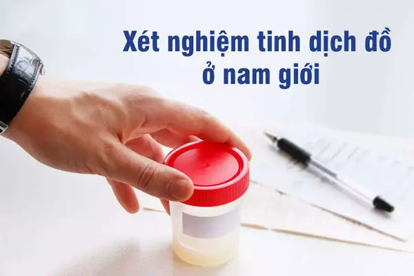 Xét nghiệm tinh dịch đồ hết bao nhiêu tiền? bảng giá 2025