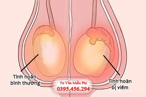 Top 6 bệnh viện phòng khám tinh hoàn uy tín tại Hà Nội