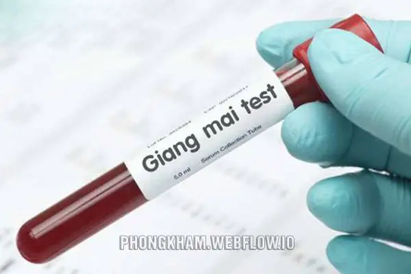 Xét nghiệm giang mai sau bao lâu là chính xác?