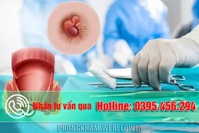 Review cắt trĩ bao lâu thì lành? Có đau không? Nên cắt trĩ ở đâu tốt tại Hà Nội