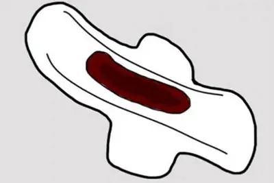 Kinh nguyệt màu đen có thai không? BS Thành giải đáp