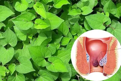Cách trị bệnh trĩ tại nhà bằng rau diếp cá
