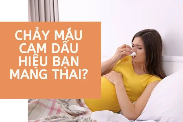 Chảy máu cam cũng là dấu hiệu có thai