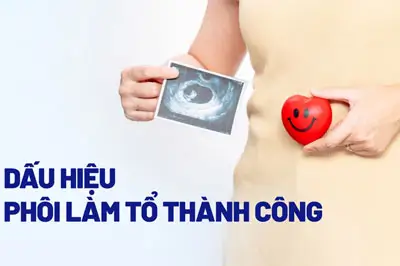 Dấu hiệu thai đã vào tổ an toàn sau quan hệ chính xác nhất [TOP 7]