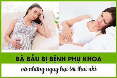 Bà bầu bị viêm phụ khoa phải làm sao? Có nguy hiểm không?