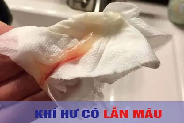 Khí hư có lẫn máu