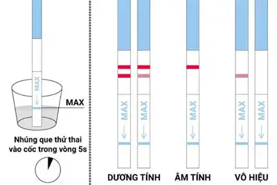 Trễ kinh 20 ngày thử que 1 vạch đậm có thai không?