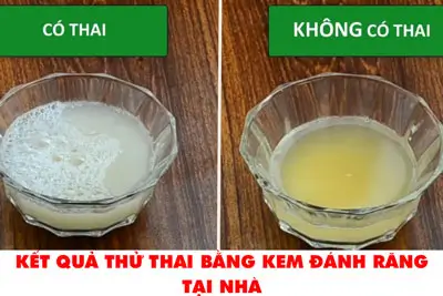 Thử thai bằng kem đánh răng tại nhà như thế nào đúng và chính xác