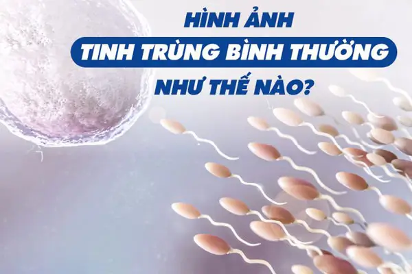 Hình ảnh tinh trùng bình thường khỏe mạnh ở nam giới