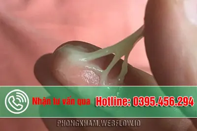 Huyết trắng màu vàng nguyên nhân do đâu có nguy hiểm không bác sĩ?