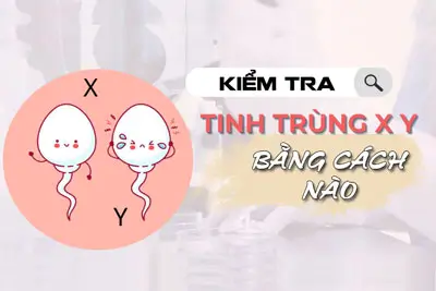 Kiểm tra tinh trùng X Y bằng cách nào chi phí hết bao nhiêu