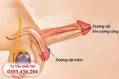 Dương vật cương lâu 6 nguyên nhân cách khắc phục
