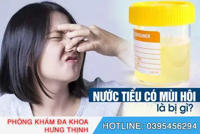 Nước tiểu có mùi hôi là bị bệnh gì cách điều trị