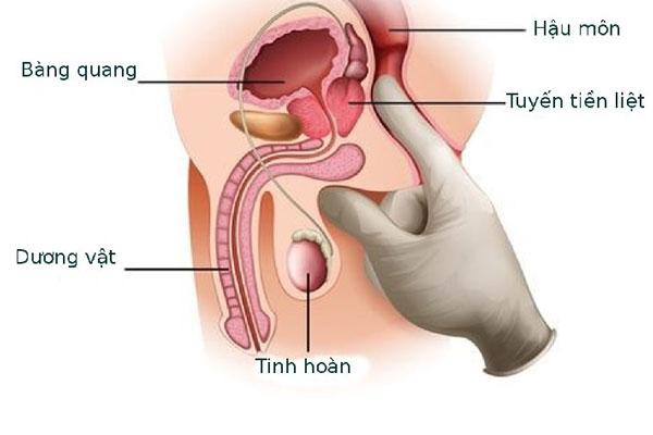 Tiền liệt tuyến trong bộ phận sinh dục nam