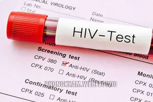 15 địa chỉ xét nghiệm HIV ở đâu tốt nhất tại Hà Nội năm 2026